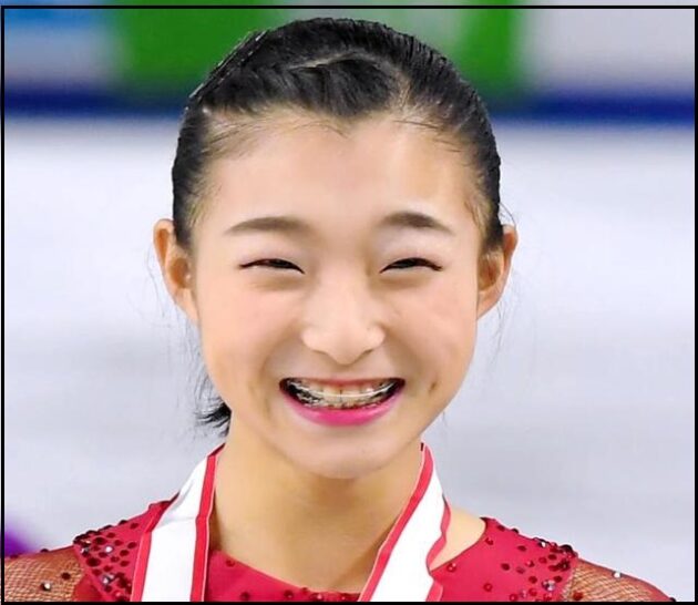坂本花織は一重で目が細いけどかわいい 小顔で雛人形みたい 体型はゴツいし猫背で残念 芸能人キャリアまとめインターナショナル