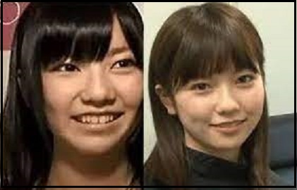 画像 島崎遥香の顔が変わった 鼻が激変 劣化して老けたとの声も 芸能人キャリアまとめインターナショナル